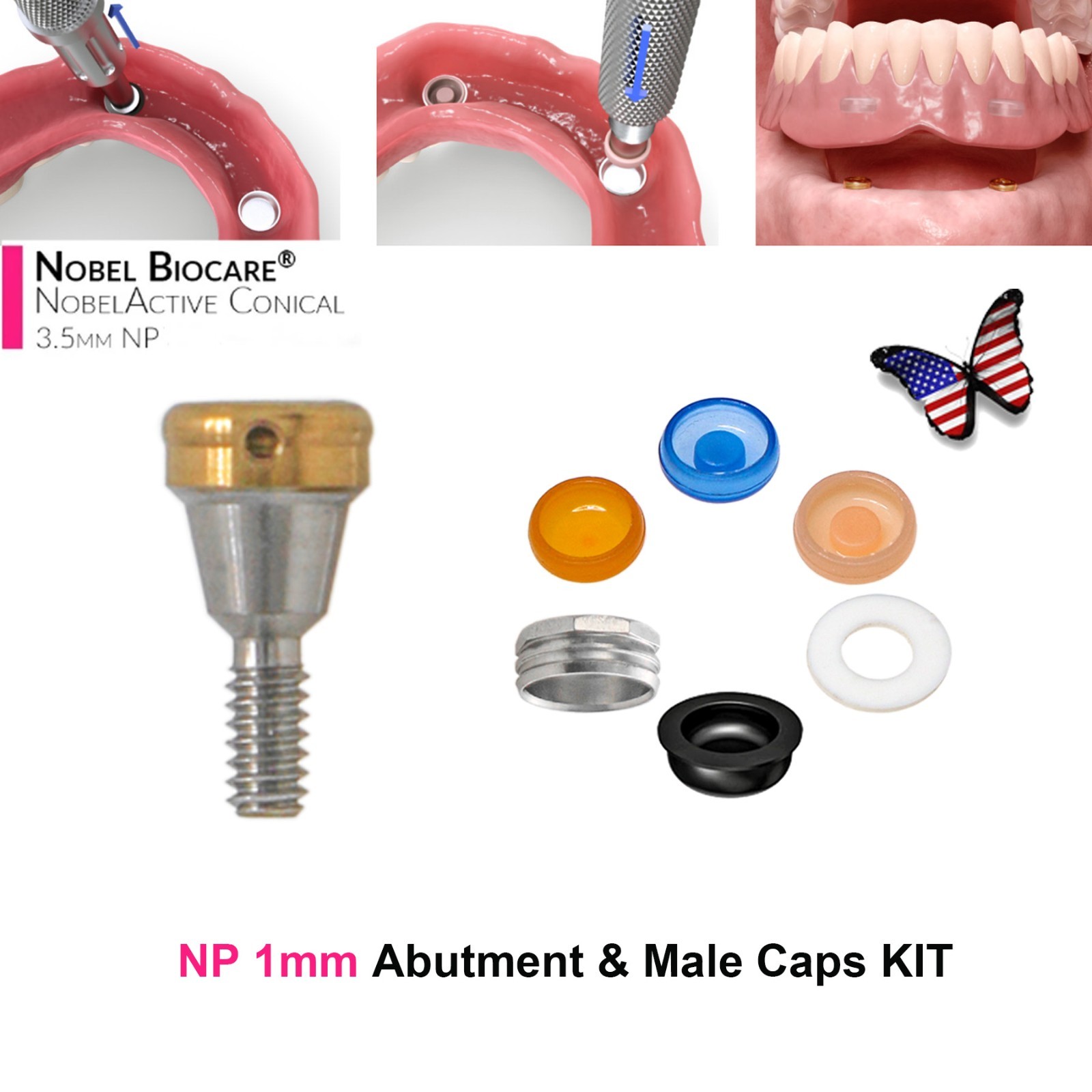 US Dental Locator Abutment NP/RP 3.5/4.3mm Fits Nobel Active Implant Overdenture
