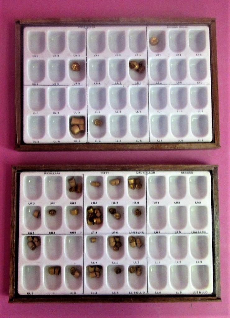 65 pc Unitek Dental Molar & Bicuspid Gold Aluminum Preformed Permanent Crown Lot