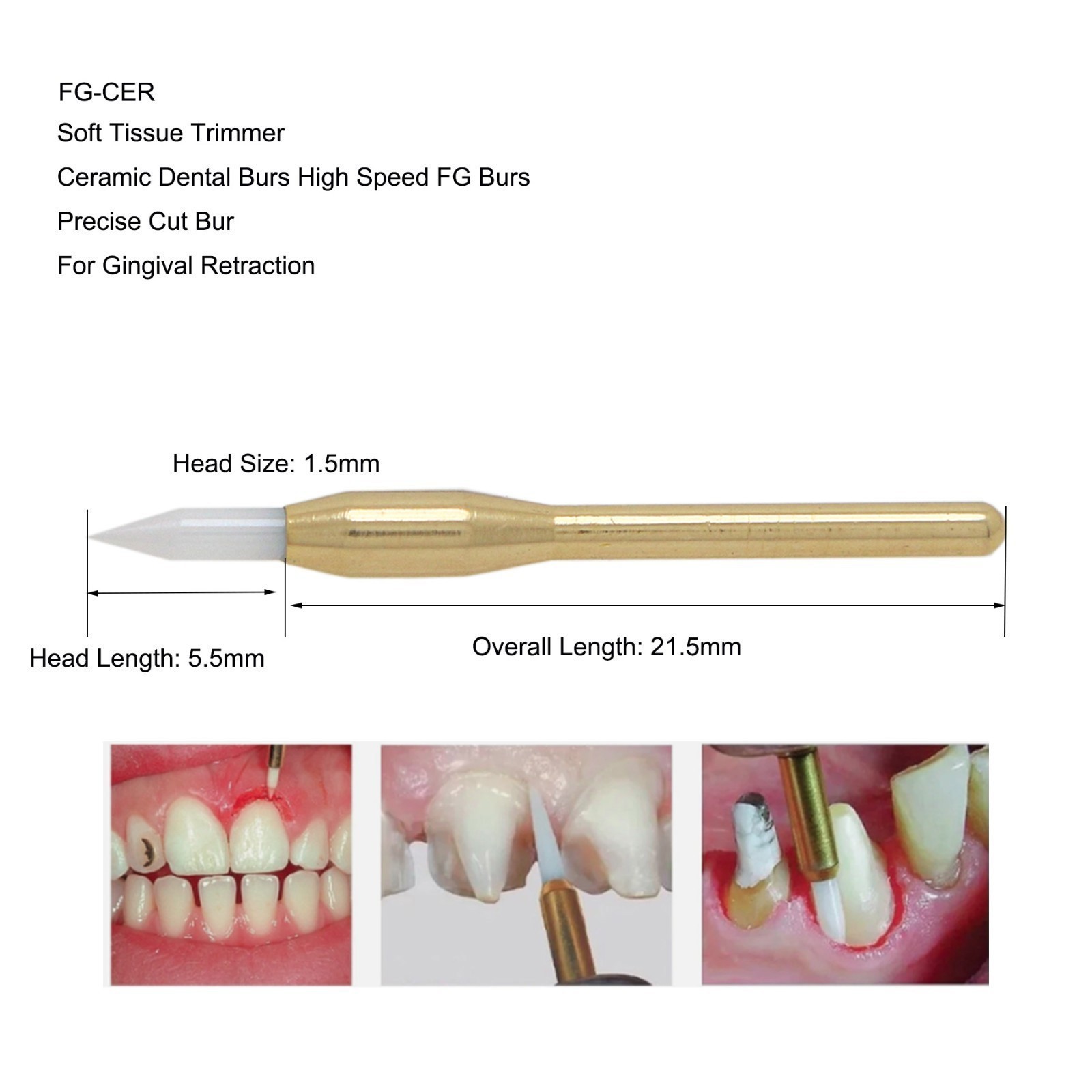 Dental Surgical Ceramic Soft Tissue Trimmer Bur for Gingivectomy