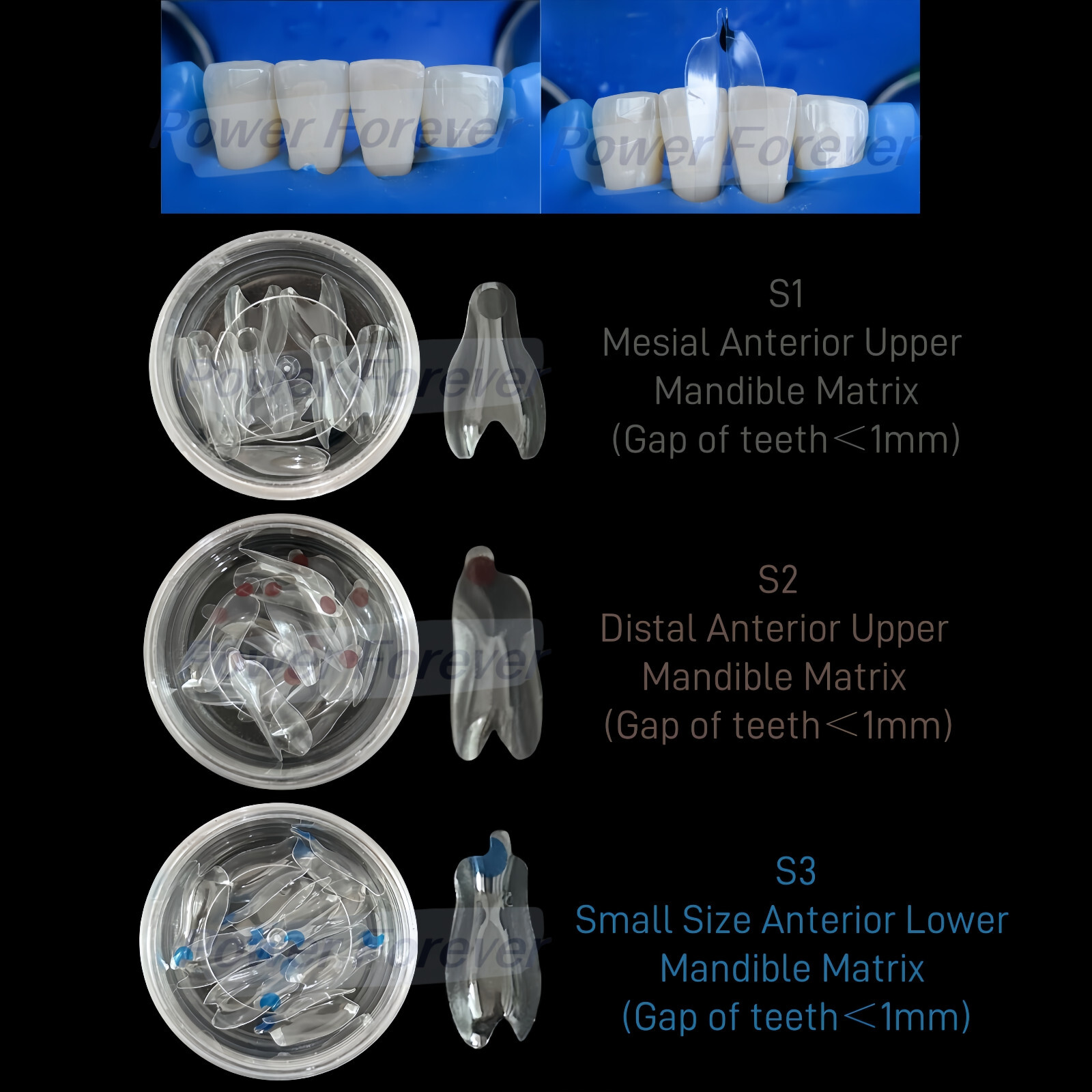 Dental Clear Matrix Anterior Posterior Restorative BT Bow Matrices Fit BioClear