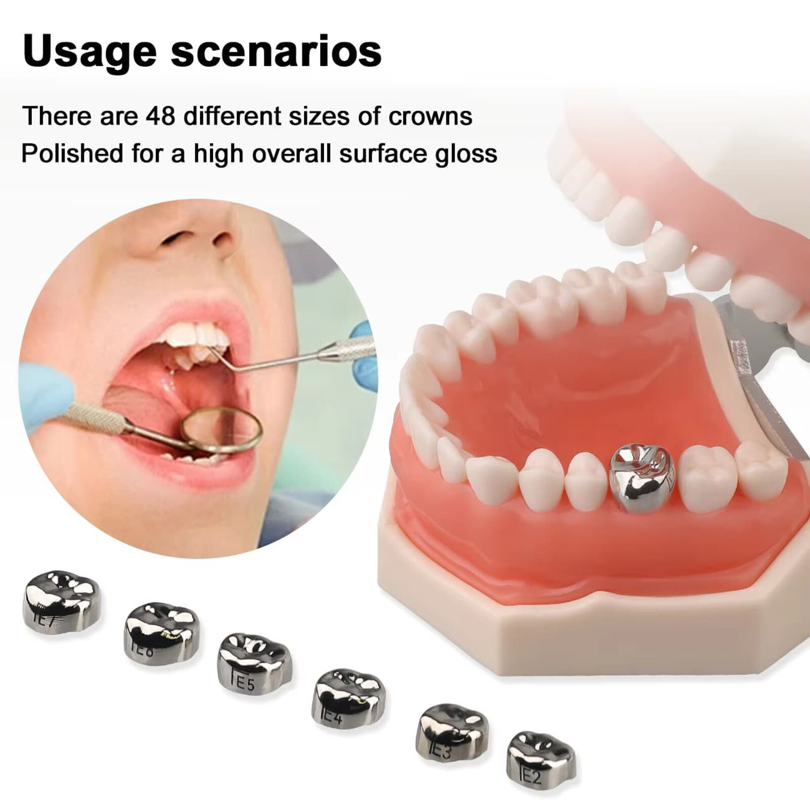 48 ASSORTED PRIMARY MOLAR STAINLESS STEEL CROWNS – COMPLETE KIT