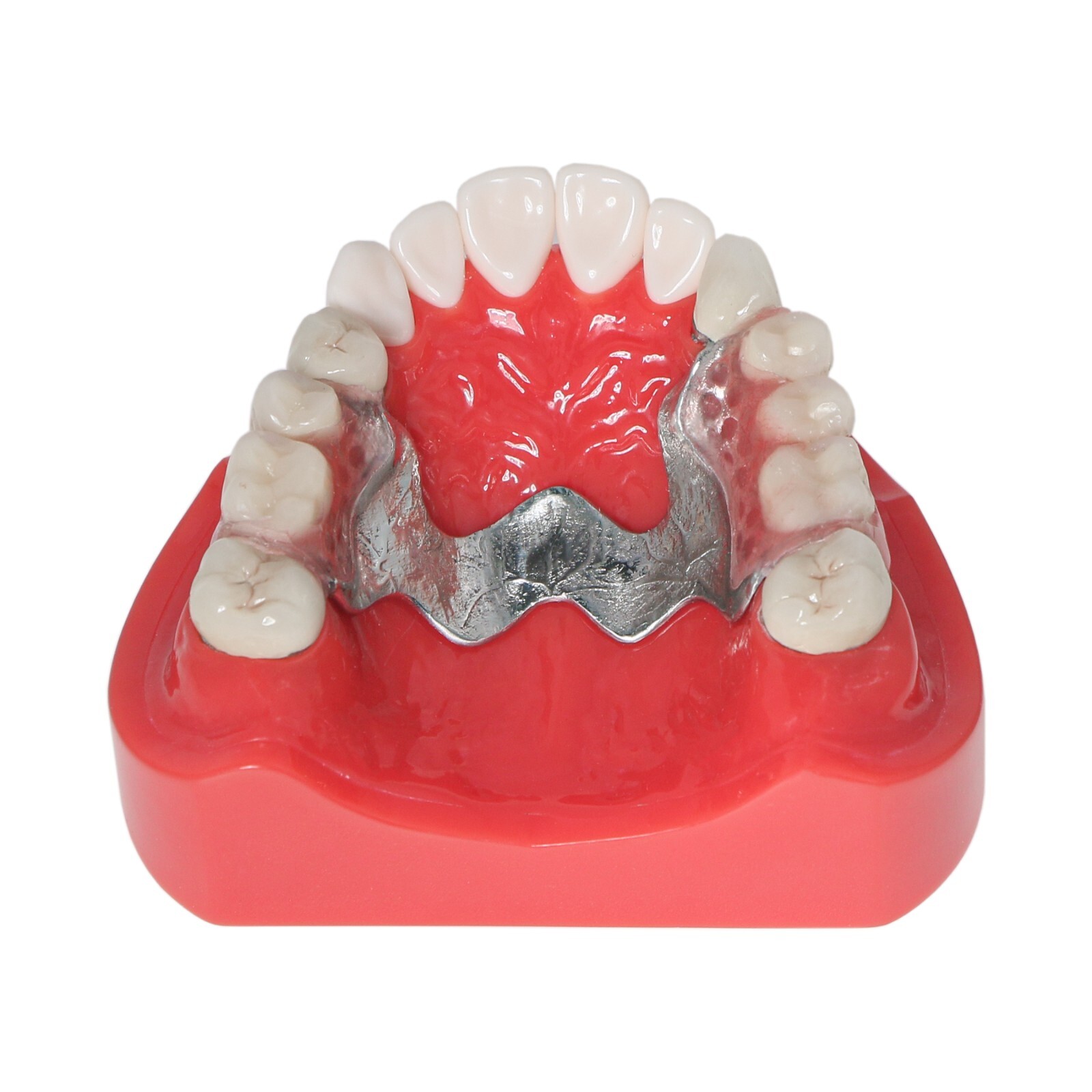 Dental Typodont Teeth Model Implant Pathological Perio Restoration Practice Demo