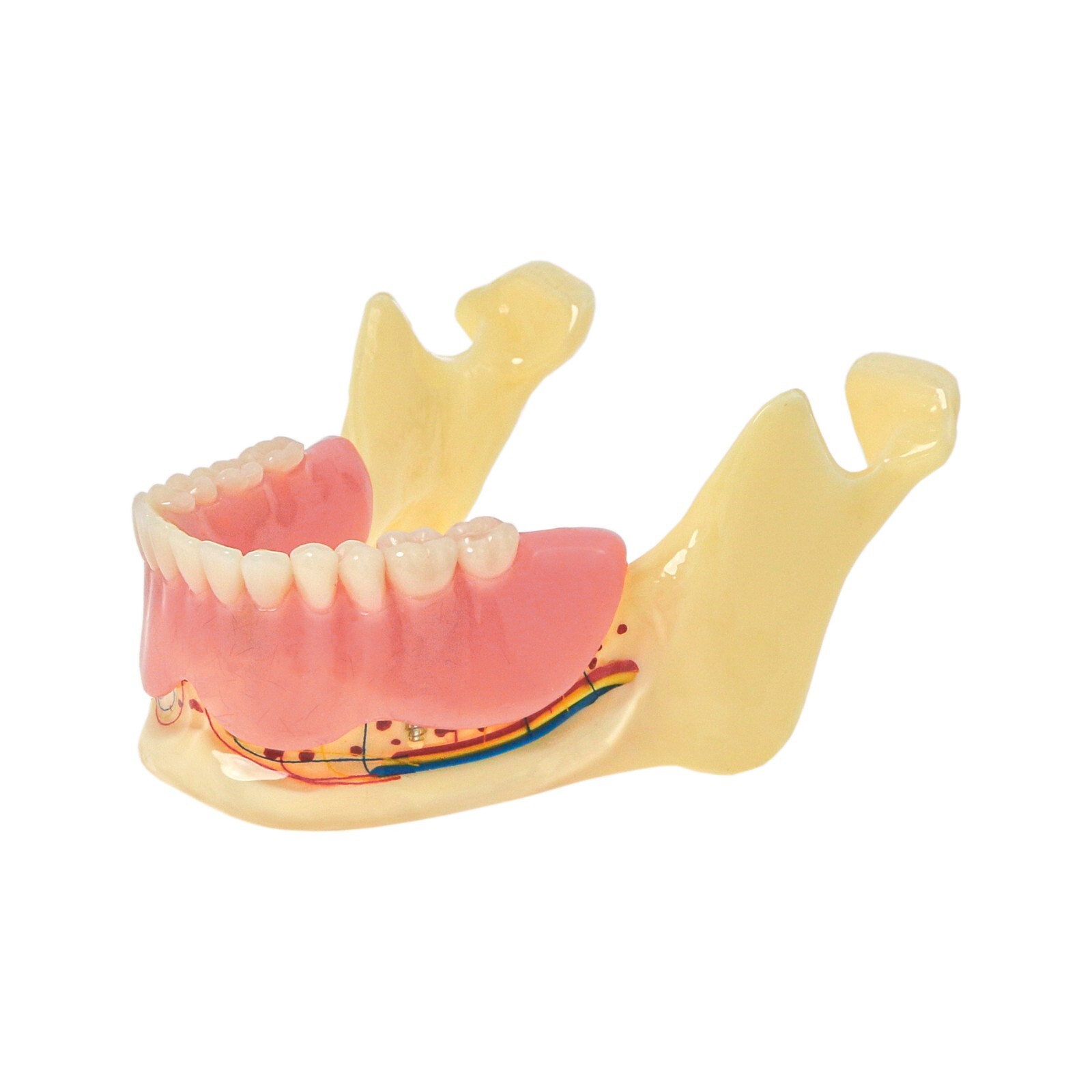Dental Typodont Teeth Model Implant Pathological Perio Restoration Practice Demo