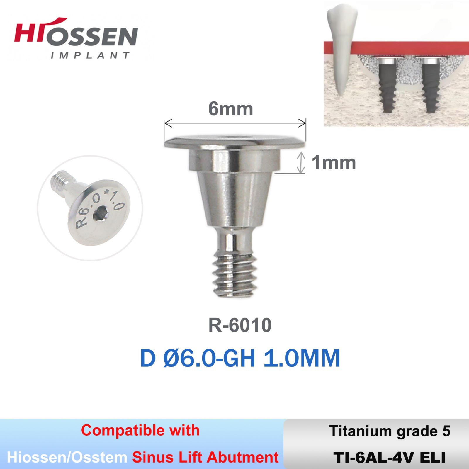 Sinus Lift Temporary Abutments Ti Superline fit Hiossen/DIO UFI/II R/CSM ITI RN