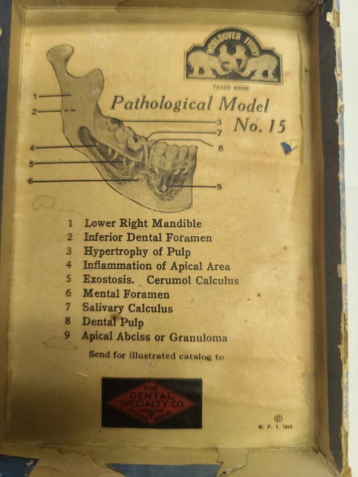 Vintage Medical Dental Education Anatomical Jaw Pathological #15 See Description