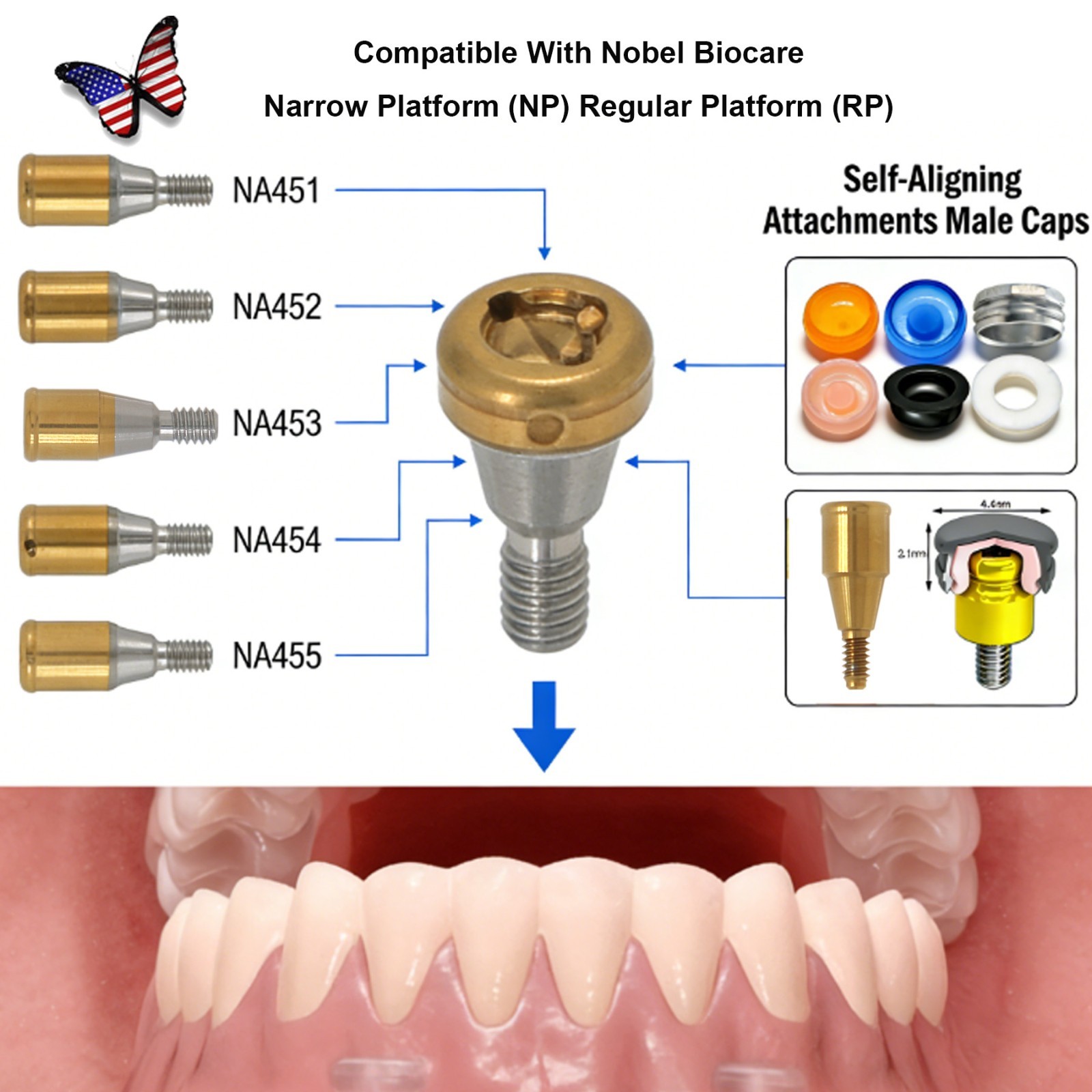 US Dental Locator Abutment NP/RP 3.5/4.3mm Fits Nobel Active Implant Overdenture