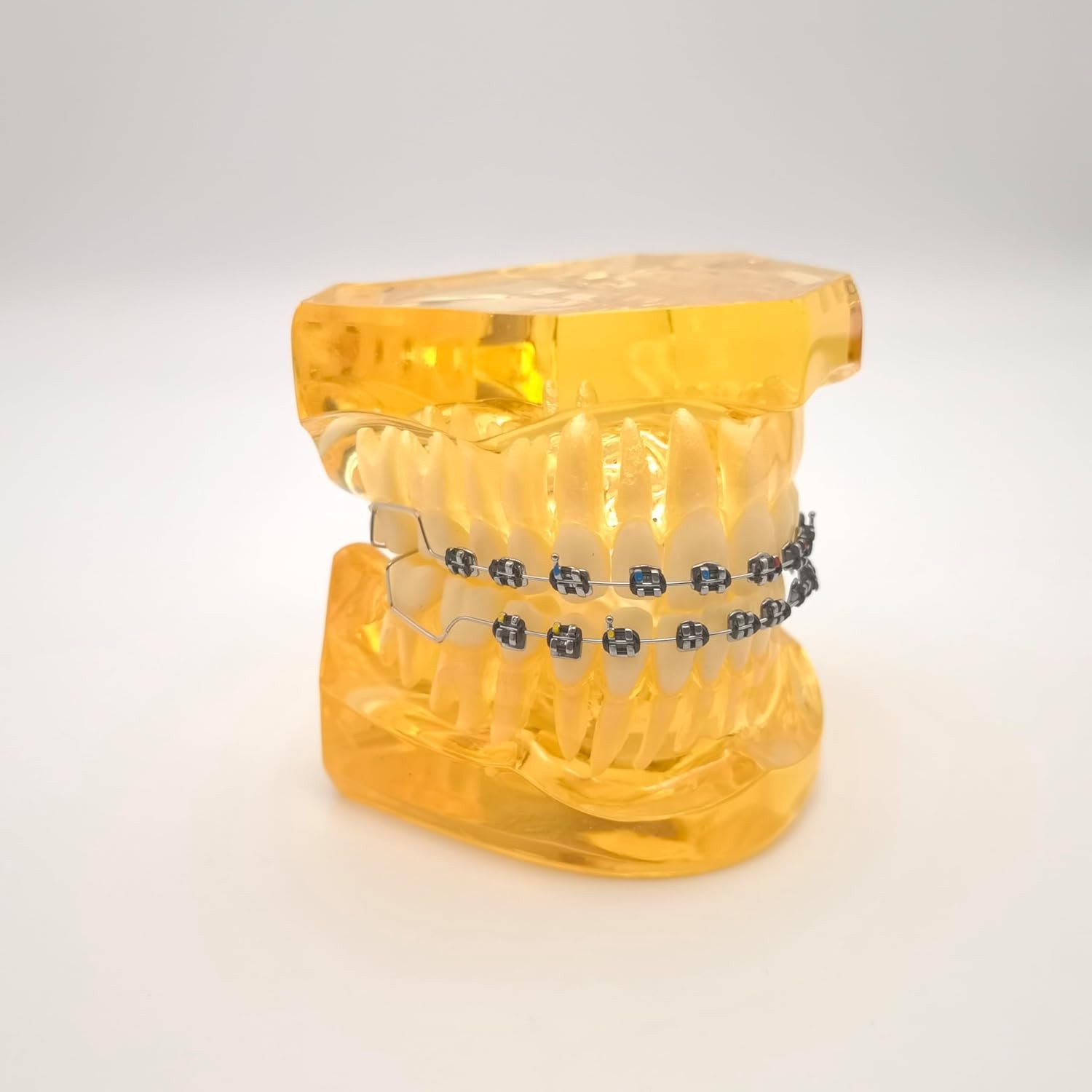 Temporary Tooth Decoration Fake Braces with Metal Wires Ortho Patient Education