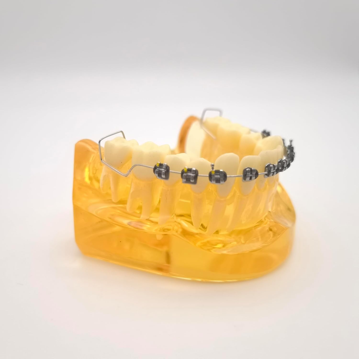 Temporary Tooth Decoration Fake Braces with Metal Wires Ortho Patient Education