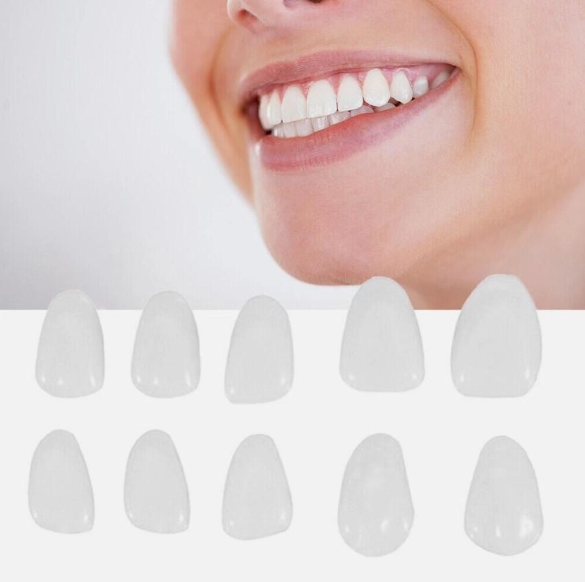 Dental Porcelain Veneers Upper Teeth Shade Patch Temporary Crown USA