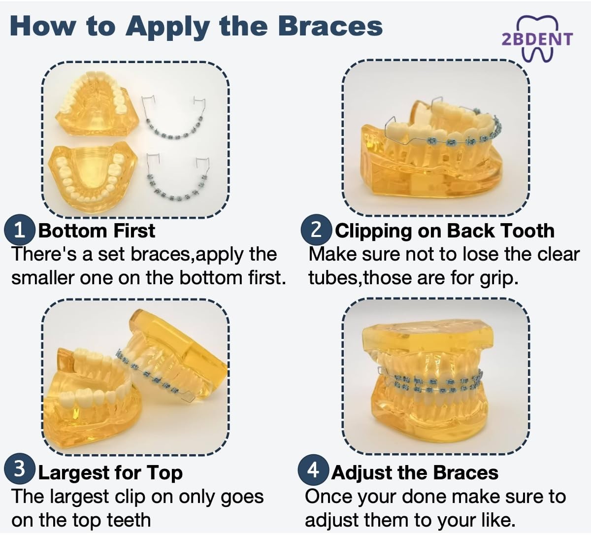 Temporary Tooth Decoration Fake Braces with Metal Wires Ortho Patient Education