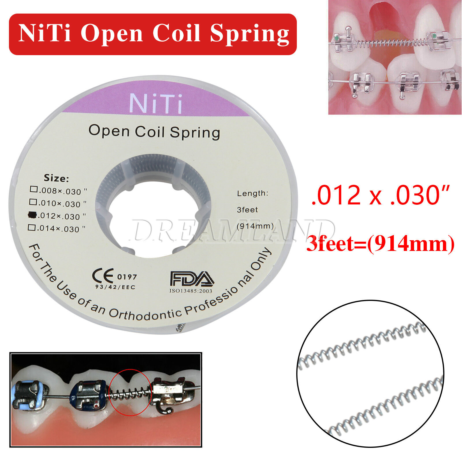 Dental Ortho Niti Open Coil Spring 012*030″ *914mm